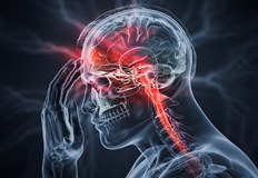 Световните здравни организации препоръчват метода FAST за бързо разпознаване на