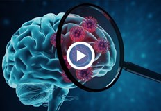 Учени откриха че хора с лош белтък в мозъка десетилетия