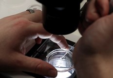 Мутация в гена TP53 е открита при репродуктивен материал използван