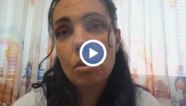 Майката на двегодишното дете настоява за пълна забрана на тротинетките след инцидента