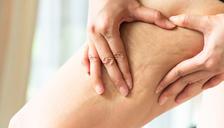 Двете състояния имат различни характеристики и лечение, въпреки сходния външен вид Двете състояния имат различни характеристики и лечение, въпреки сходния външен вид