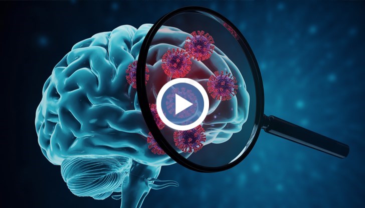 Учени откриха, че хора с "лош белтък" в мозъка десетилетия наред не развиват Алцхаймер заради добро съдово здраве