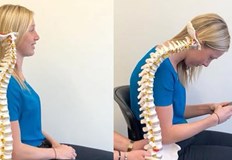 Лекари предупреждават за нарастващи проблеми с гръбнака заради прекомерна употреба