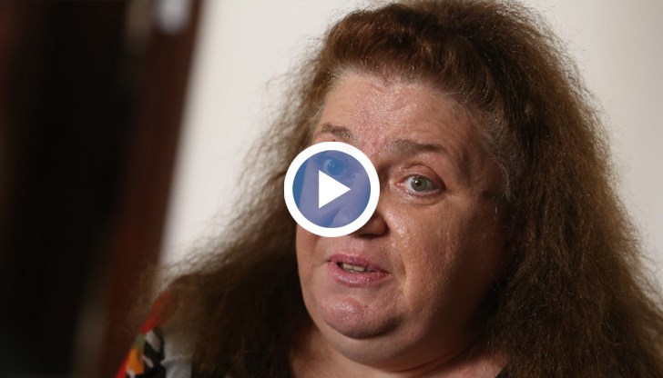 Проф. Радостина Александрова: Нимбус се разпространява бързо, но няма сигнал за тревога