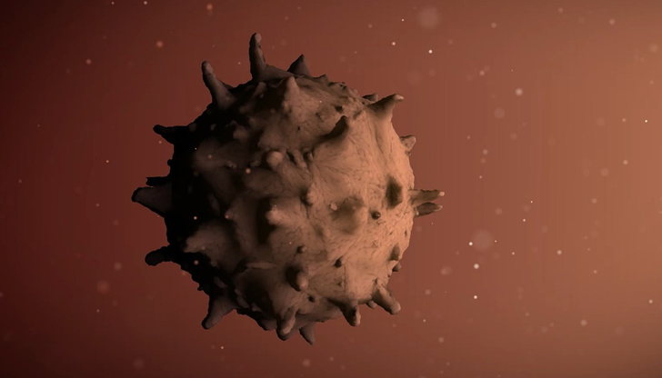 Симптомът се описва като усещане за бръснарско ножче“Нов вариант на