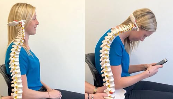 Лекари предупреждават за нарастващи проблеми с гръбнака заради прекомерна употреба