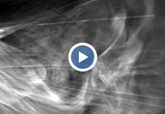 Кадрите от декември 2024 разкриват нови детайли за слънчевата корона