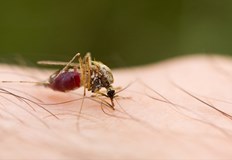 Пациентът от София е изписан в добро състояние след хоспитализацияПърви