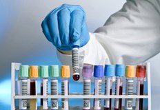 Американско изследване показва че биомаркерите в кръвта съдържат ранни сигнали