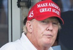 Американският президент прегледан заради подуване в краката и синини по