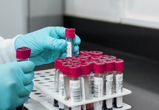 Първият смъртен случай в окръг Коконино от 2007 годинаПациент от