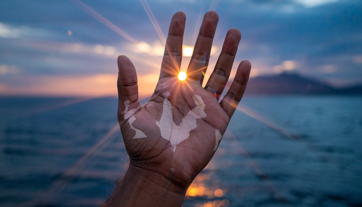 UVA лъчите разрушават колагена и предизвикват бръчки и петна UVA лъчите разрушават колагена и предизвикват бръчки и петна