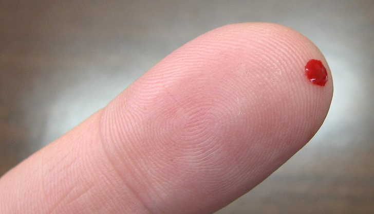 Тестът е бърз и изисква капка кръв, която се взема