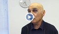 Пребитият фелдшер: Нападателят ме удряше по лицето и главата