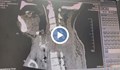 Медицински пробив: Китайски хирурзи спасиха мъж с прекършен врат