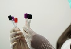 Регистрирани са шест смъртни случая за последните 12 месеца