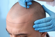 Мартин Лачман се разболял преди да започне процедурата в клиника