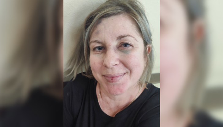 Полицията търси украинска гражданка, която е нападнала служители