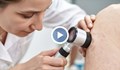 Лекари разкриват нови терапии срещу кожния меланом
