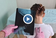 Специалисти Ако деформациите не се открият навреме може да се