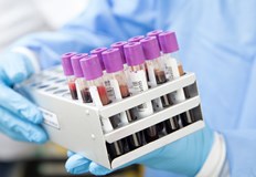 Пациентка от Карибите се оказа единствената с новооткрита кръвна групаФренски