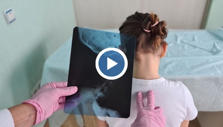 Специалисти: Ако деформациите не се открият навреме, може да се стигне до хирургическа намеса