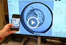 Иновативна time lapse система дава достъп в реално време Инвитро клиника София