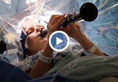 Дениз Бейкън претърпя дълбока мозъчна стимулация в ЛондонПациентка с болестта