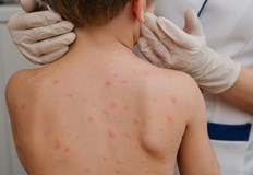 Имунизацията ще обхване 54 000 деца родени през 2025 годинаМинистерството