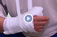 Лекари отчитат ръст на битовия травматизъм