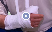 Лекари отчитат ръст на битовия травматизъм