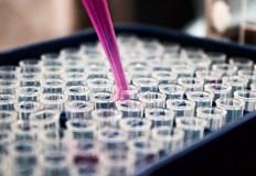 Продуктът Urify променя цвета си при наличие на белтък в