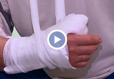 Най чести са травмите при рязане на дърва и опасни селфита Водещи