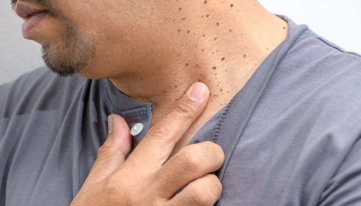 Ефикасен домашен метод помага за чиста кожа