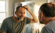 Ново лечение възстановява растежа на косата с 539%