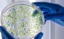 Фармацевт разясни разликите между пробиотици, синбиотици, постбиотици и парабиотици