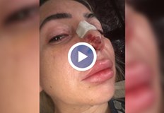 Д р Зекерия Батмаз извършил над 2000 операции без необходимата