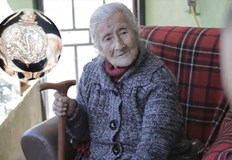 Рентгенова снимка разкри феномена литопедион след падане на възрастната чилийкаУникалният