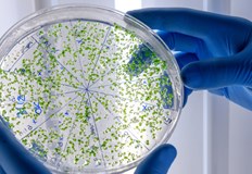 Недко Кузманов предупреди че пробиотиците не са чудодейни без правилно