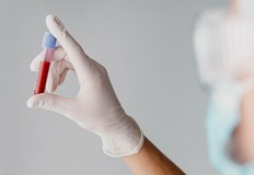 От лечебното заведение призовават здрави хора от всички кръвни групи