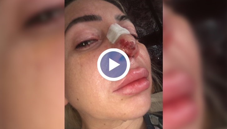 Д-р Зекерия Батмаз извършил над 2000 операции без необходимата специализация