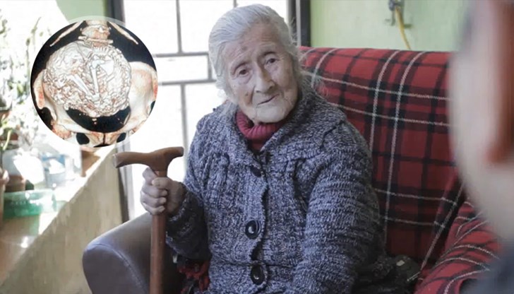 Рентгенова снимка разкри феномена "литопедион" след падане на възрастната чилийка Рентгенова снимка разкри феномена "литопедион" след падане на възрастната чилийка