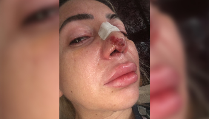 Д-р Зекерия Батмаз извършил над 2000 операции без необходимата специализацияЛекар,