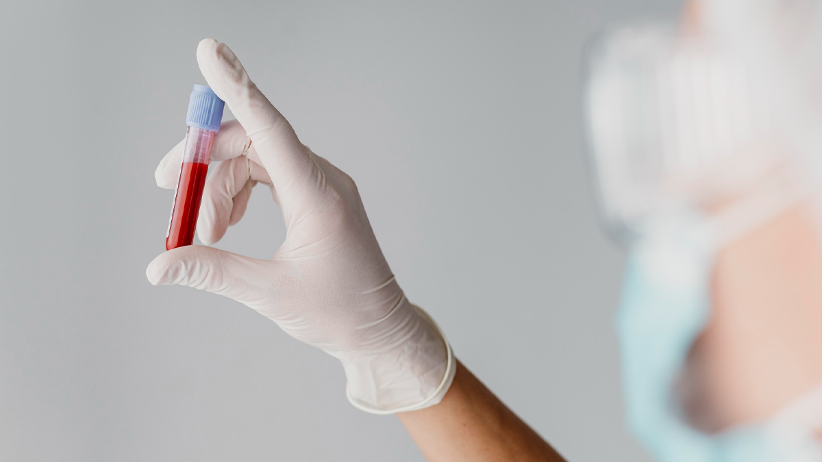 От лечебното заведение призовават здрави хора от всички кръвни групи