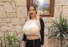 Притежателката на най големите устни в света заяви че е