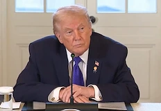 Болниците в Иран не успяват да поемат хилядите ранениСветът е