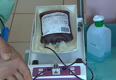 Пациенти и техни близки сигнализират за изгубено ценно време и