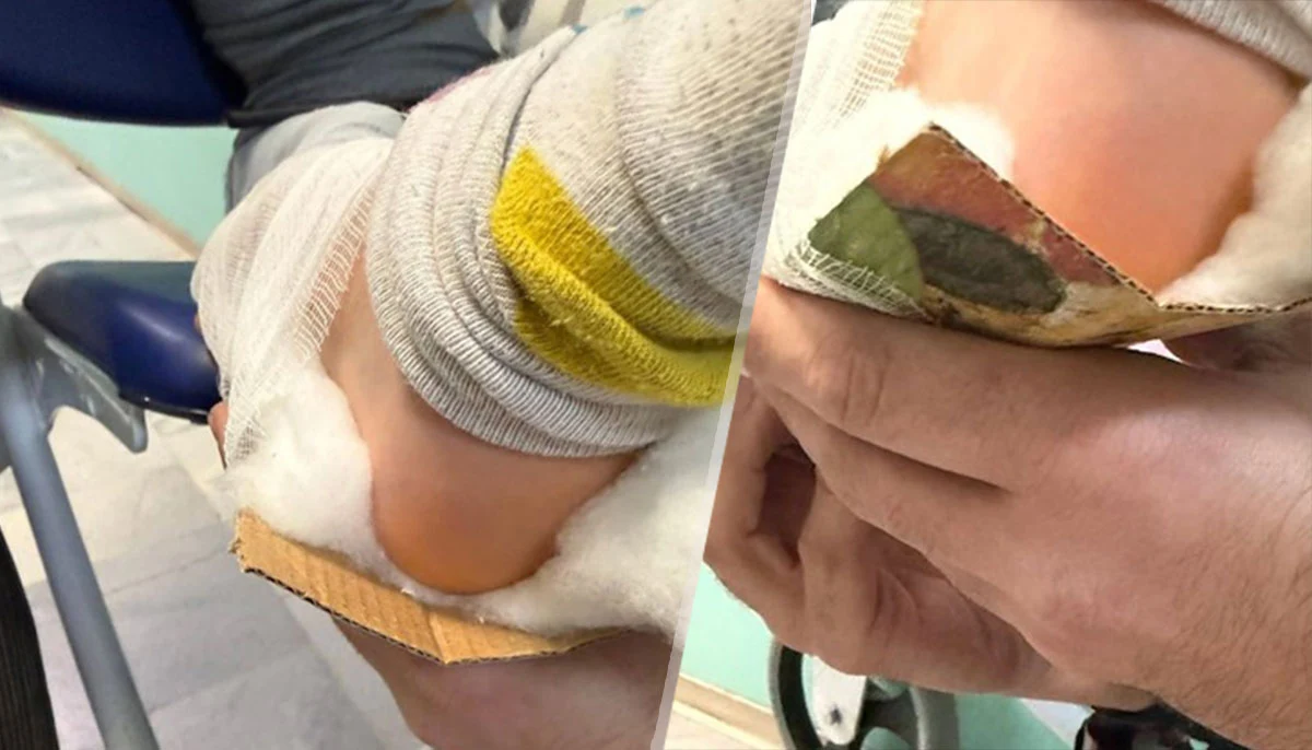 Още едно дете получи картонена шина в Спешния центърМедицински специалисти