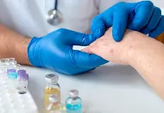 Най много са болните деца във ВрачанскоСлучаите на морбили в България