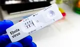 Оксфордски учени разработват нова ваксина срещу ебола